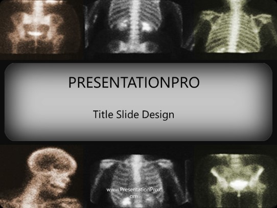 Xrays PowerPoint Template title slide design