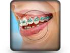 Orthodontic Squareraces Square PPT PowerPoint Image Picture
