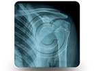 X-Ray Shoulder 01 Square PPT PowerPoint Image Picture