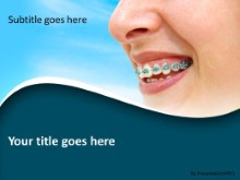 Orthodontic Braces PPT PowerPoint Template Background